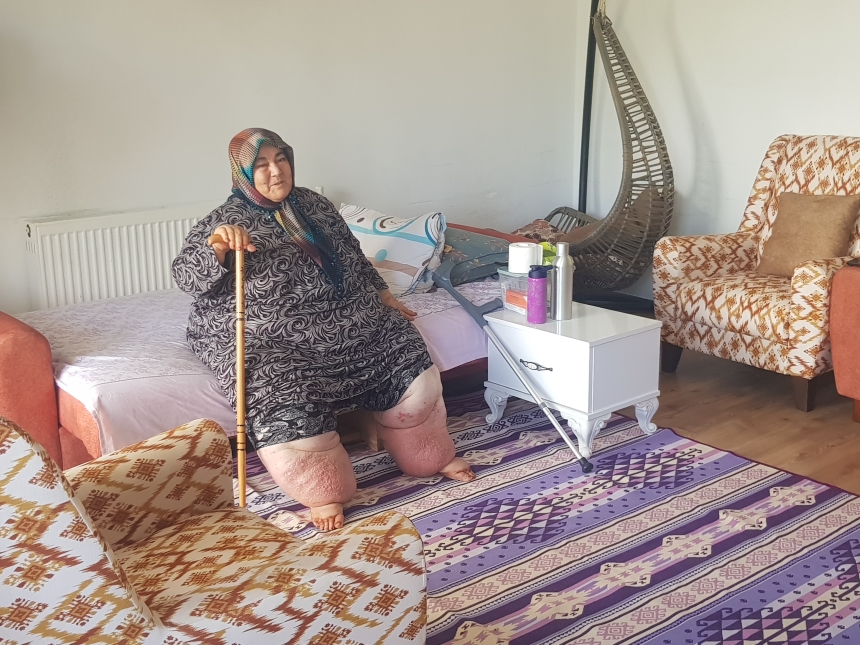 Osmaniye’de Fil Hastası Emine Teyze'nin Tekerlekli Sandalyeye Hasreti Son Buldu (1)