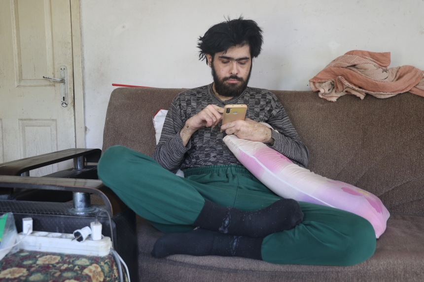 Deprem Sonrası Hayattan Koptu 3 Yıl Sonra Hayata Döndü (6)