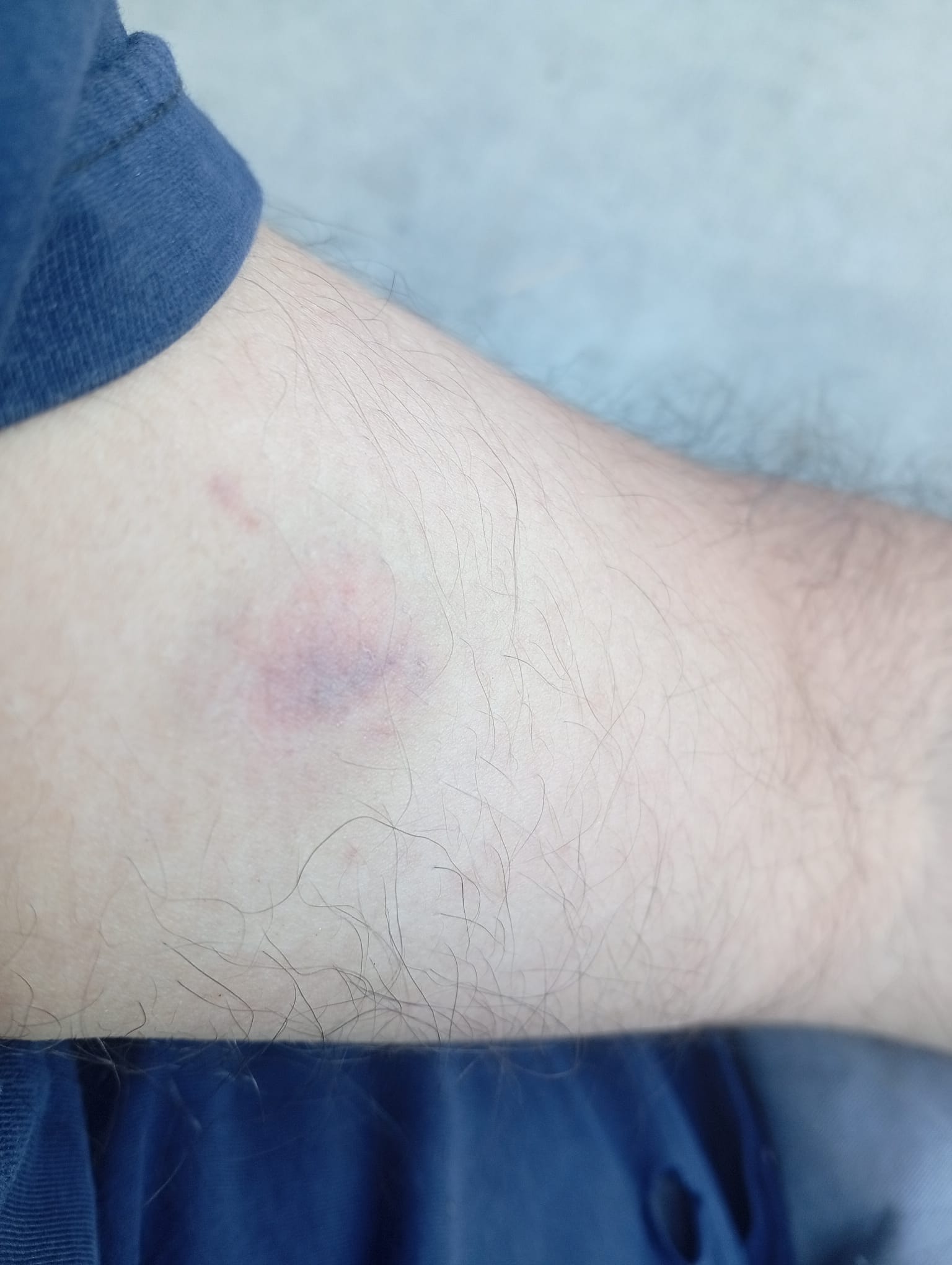 'Kenara Çekilir Misiniz' Uyarısı Kavgaya Dönüştü (2)