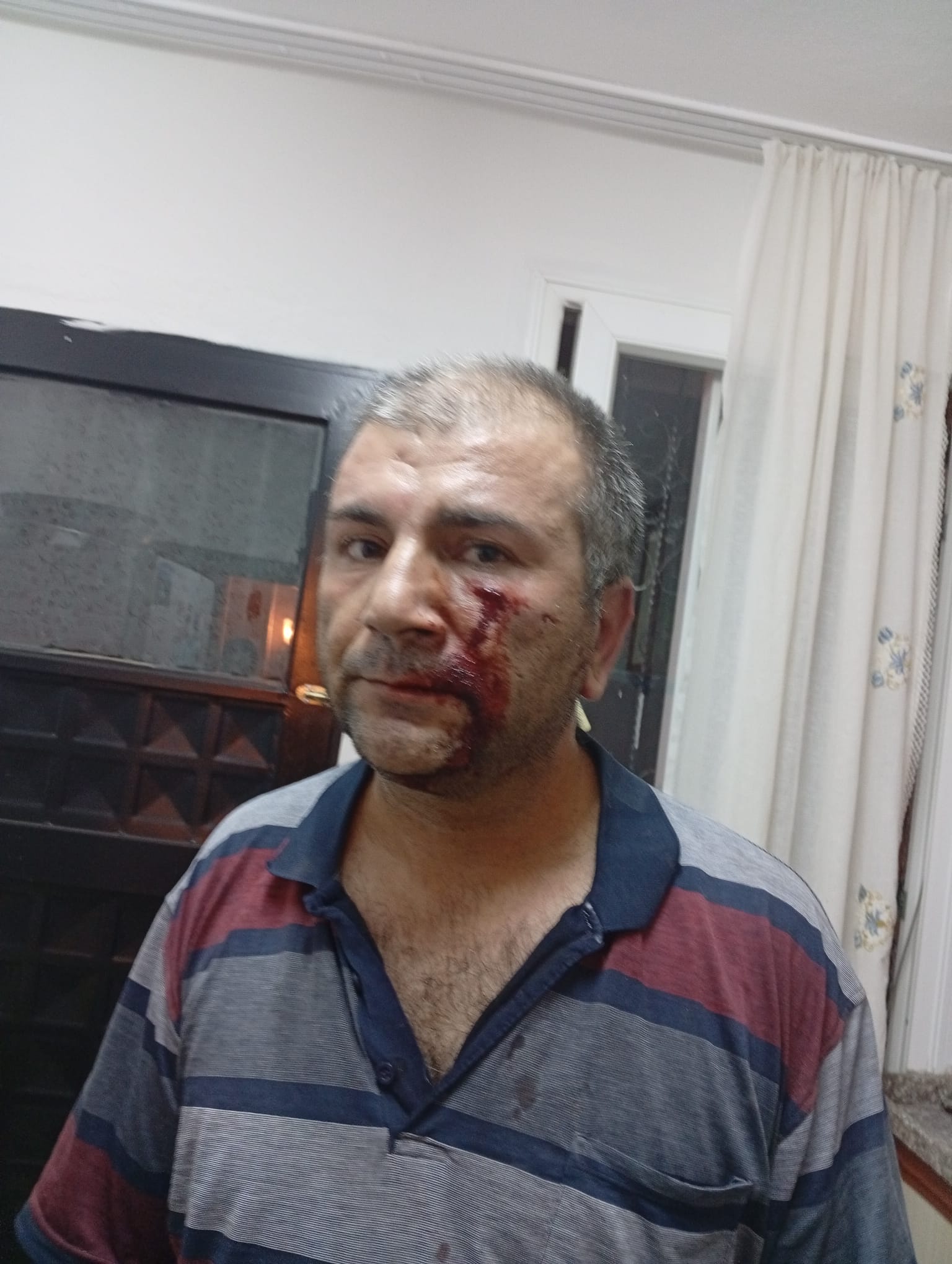 'Kenara Çekilir Misiniz' Uyarısı Kavgaya Dönüştü (3)