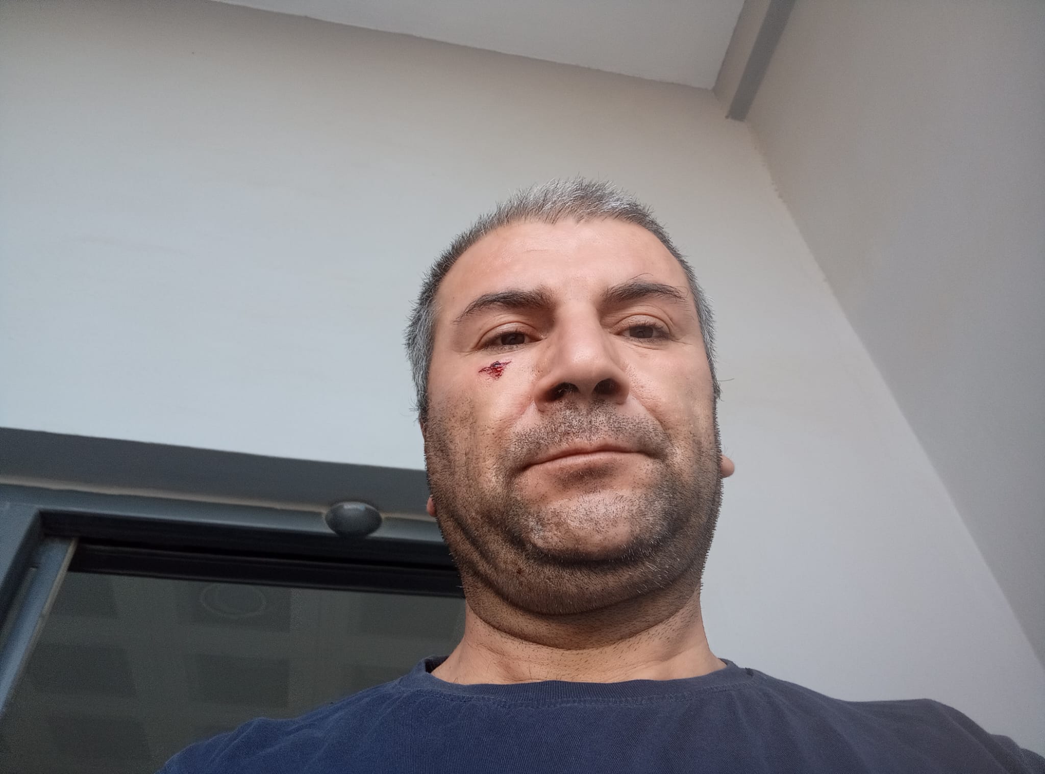 'Kenara Çekilir Misiniz' Uyarısı Kavgaya Dönüştü (4)