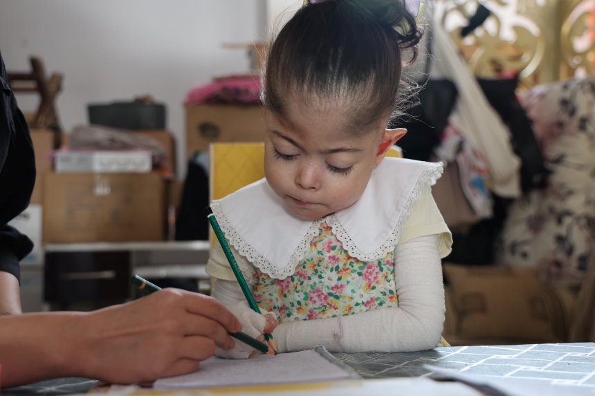 Kelebek Hastası Fatma'nın Okulsuz Başarısı (4)