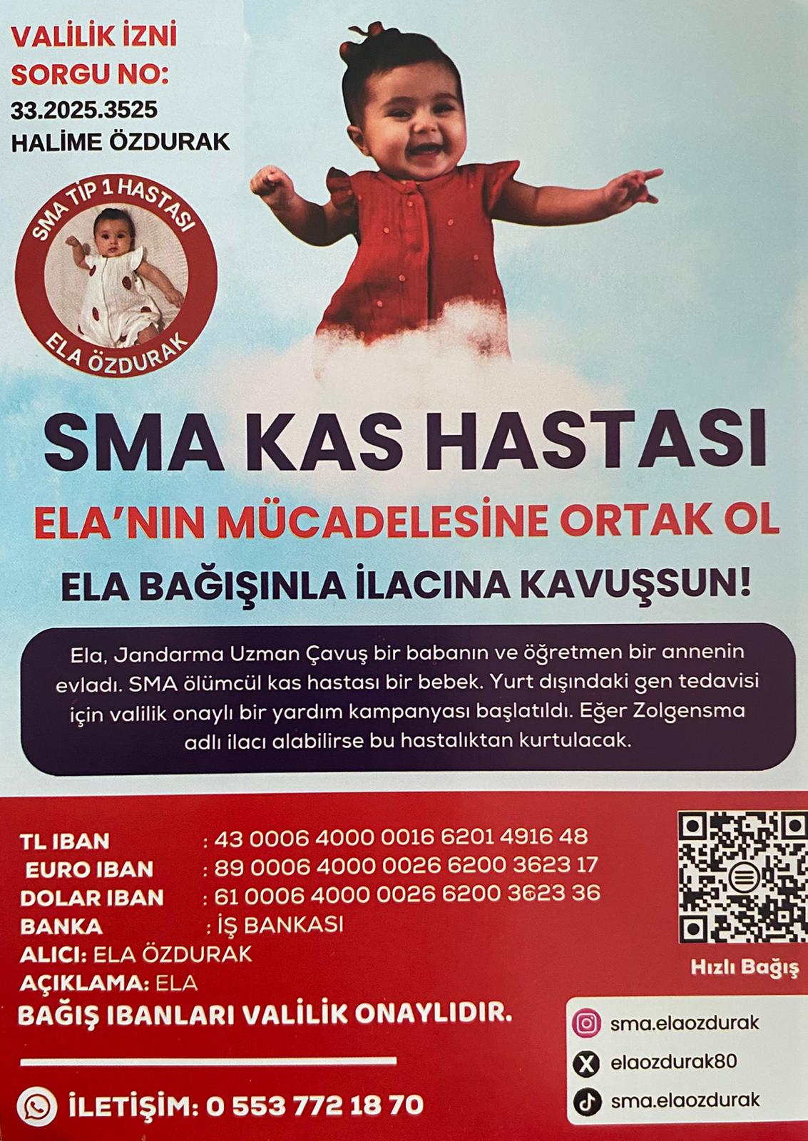 Osmaniye Sma Hastası Ela Bebek Eli-1