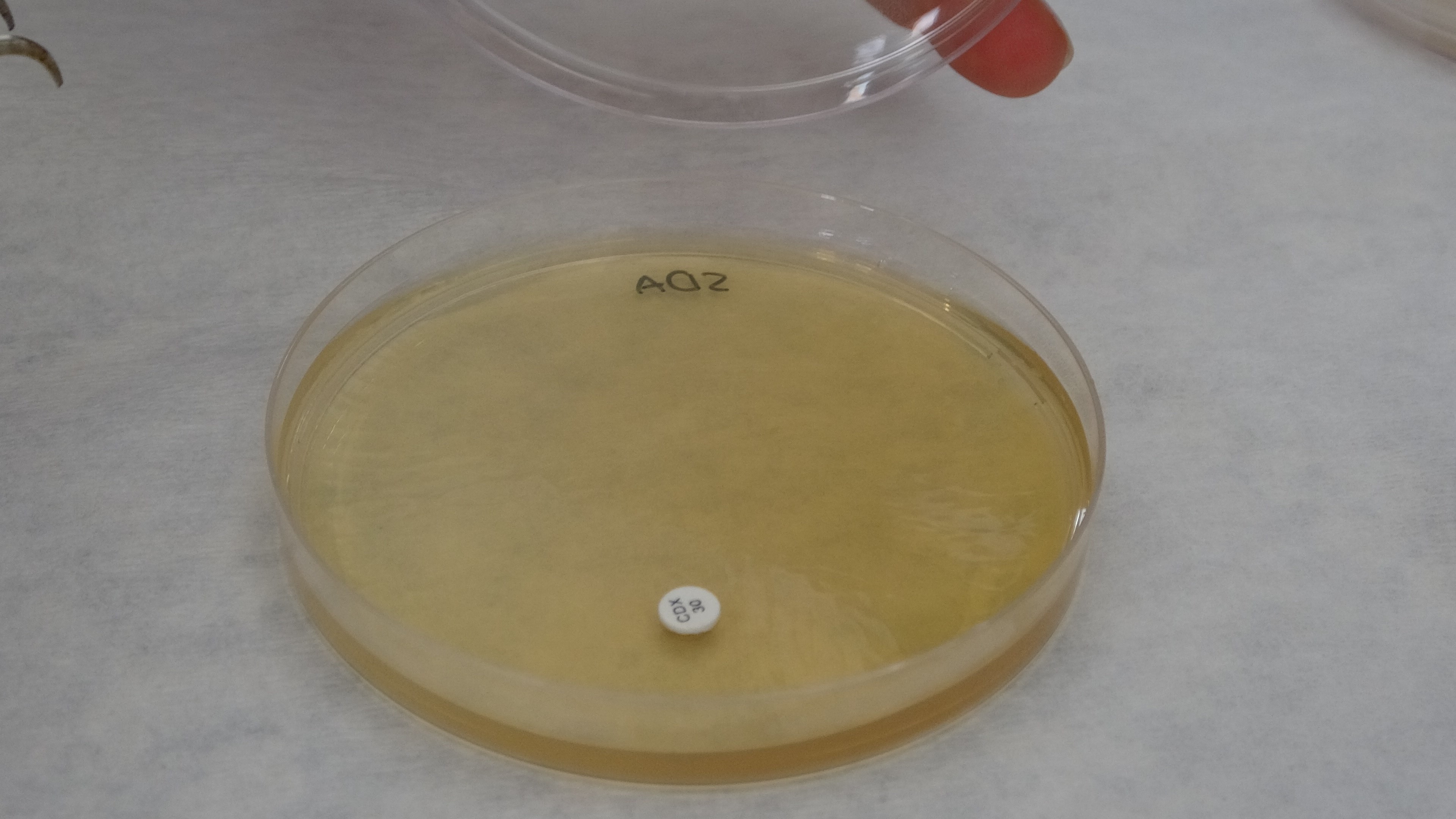 Sarı Kantaron Devri Bitiyor MuU