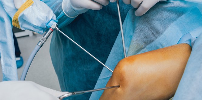 Diz Ağrısııı (1)