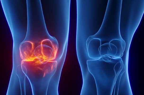 Diz Ağrısııı (2)