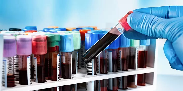 Kan Testi Hayatınızı Kurtarabilir (1)