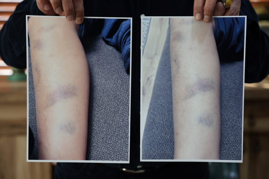 Özel Okulda Eğitim Gören 8 Yaşındaki Çocuğa Şiddet Iddia