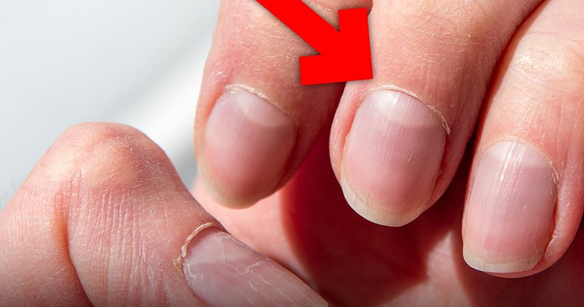 Tırnaktaki Lunula Nedir