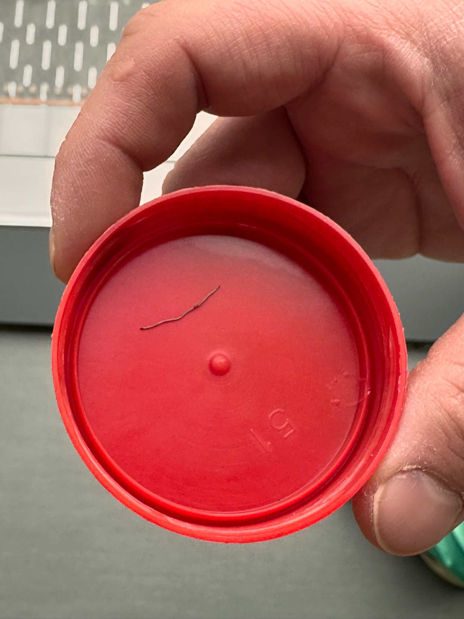 1 Yaşındaki Bebeğin Sırtından Zımba Teli Çıktı (4)