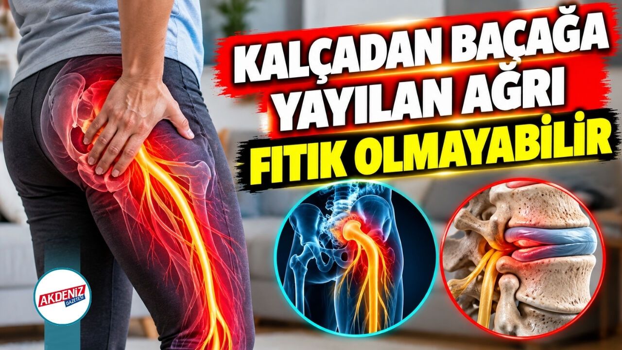Kalçadan Bacağa Yayılan Ağrı Fıtık Olmayabilir
