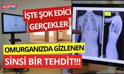 Şok gerçek: Omurga eğriliği (Skolyoz)'nin hayatınızı nasıl tehdit ettiğini öğrenin!