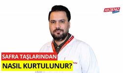 Safra taşlarından nasıl kurtulunur?