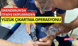 İskenderun'da İtfaiye ekiplerinden yüzük çıkarma operasyonu