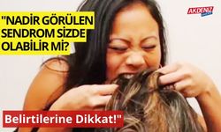 "Nadir Görülen Sendrom Sizde Olabilir mi? Belirtilerine Dikkat!"