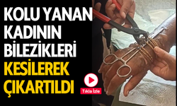 Kolu yanan kadının bilezikleri kesilerek çıkartıldı