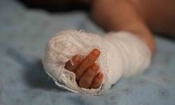 Hemşire Hatası Minik Bebeği Parmaksız Bıraktı: Aile Şokta