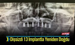 Dişsizdi 13 İmplantla Yeniden Doğdu