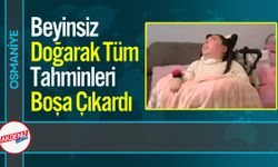 Beyinsiz Doğarak Tüm Tahminleri Boşa Çıkardı