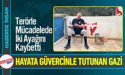 İki Ayağını Kaybetti, Hayata Güvercin Sevgisiyle Tutundu