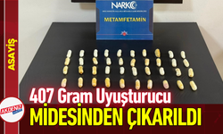 407 Gram Uyuşturucu Midesinden Çıkarıldı!