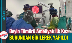 Beyin Tümörü Ameliyatı İlk Kez Burundan Girilerek Yapıldı!