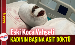 Eski Koca Vahşeti: Genç Kadının Başına Asit Döktü!