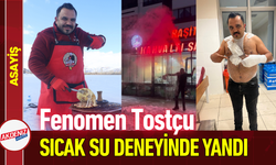 Fenomen Tostçu Sıcak Su Deneyinde Kendini Yaktı!
