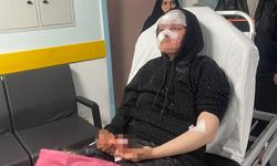 Gaziantep'te Boşanmak İsteyen Eşini Öldüresiye Dövdü