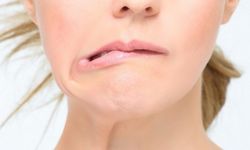 Yüz Felcinde Erken Tanı Hayati Öneme Sahip!