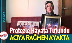 Depremde Eşini Kaybetti, Protezle Hayata Tutundu