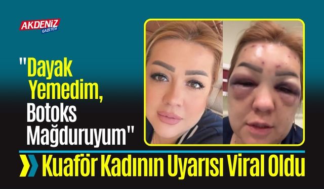 "Dayak Yemedim, Botoks Mağduruyum"