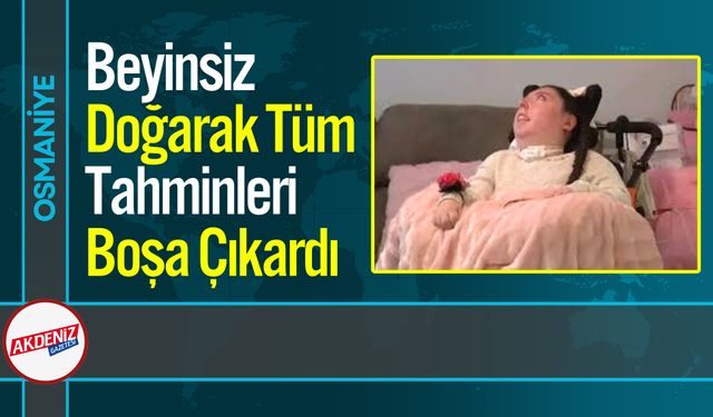 Beyinsiz Doğarak Tüm Tahminleri Boşa Çıkardı