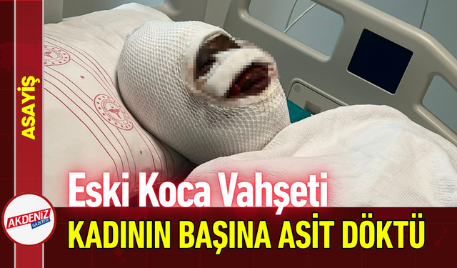 Eski Koca Vahşeti: Genç Kadının Başına Asit Döktü!