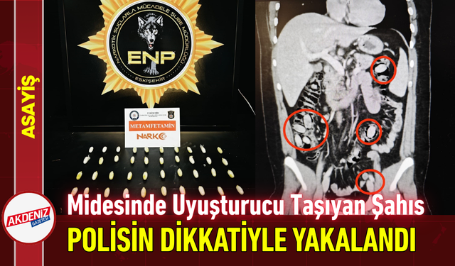 Midesinde Uyuşturucu Taşıyan Şahıs Polisin Dikkatiyle Yakalandı!