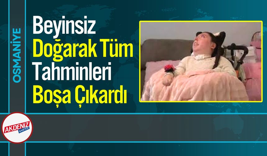 Beyinsiz Doğarak Tüm Tahminleri Boşa Çıkardı