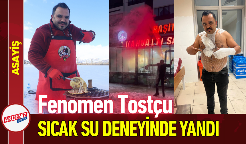 Fenomen Tostçu Sıcak Su Deneyinde Kendini Yaktı!